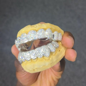 Diamond Dazzle 10/10 Full Set Grillz - Water ATL