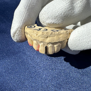 Simple Tooth Separator Grillz