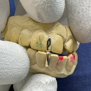 Dual Tooth Separators