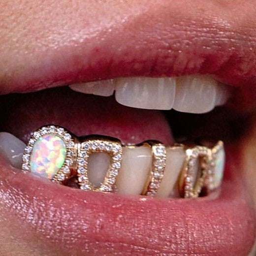 Full Customization Grillz - Build any design, any style (Deposit) - Water ATL