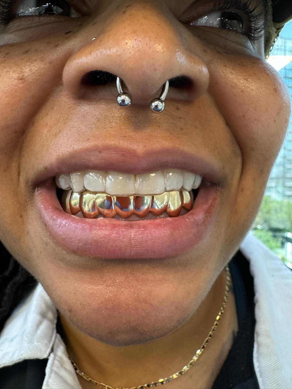 Open Bite Glam Grillz