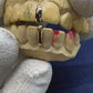 Dual Tooth Separators